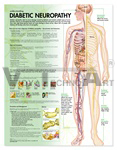 Understanding Diabetic Neuropathy Chart